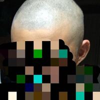 床屋でこの写真のような坊主にしてもらいたい場合何ミリって言えばいいで Yahoo 知恵袋