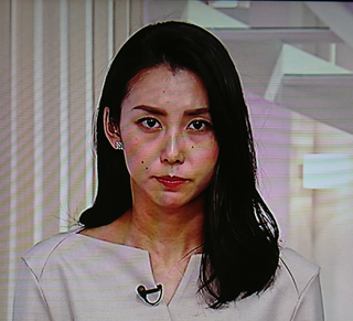 杉野真実アナのホクロはチャームポイントですか 和久田麻由子アナに 少し似ていま Yahoo 知恵袋