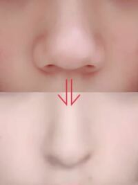 団子鼻です この写真のように団子鼻から下の鼻のようになれますか 整形でもなんで Yahoo 知恵袋