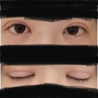 二重瞼の整形で失敗されてしまいました 今回 紹介というかたちで Yahoo 知恵袋