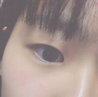 目の下に線があります 涙袋はありません これっていいものなんでしょうか 涙袋が Yahoo 知恵袋