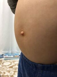 2歳半の子供のおへそですが でべそですよね 治ると思ってましたが治る傾 Yahoo 知恵袋