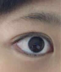 下らなくてすみません 私は目の下に生まれつき しわ があります 目が大 Yahoo 知恵袋