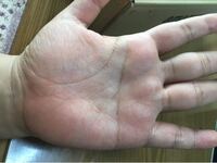 子供の手相なんですが マスカケ線 というひらがなのての字があります Yahoo 知恵袋