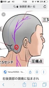 後頭部の右下だけが 痛みを感じます 珍しい痛みなので何の原因が考えられますか Yahoo 知恵袋