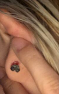 今度耳たぶにピアスを開けるのですが何度も開けてきたのですが全部膿んでダ Yahoo 知恵袋