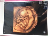 妊娠4ヶ月目 14週2日 の者です 本日妊婦検診２回目でエコー写真 Yahoo 知恵袋