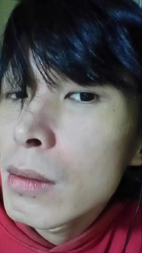 鷲鼻の整形に詳しい方 私は白人とハーフです 鷲鼻部分を削り Yahoo 知恵袋