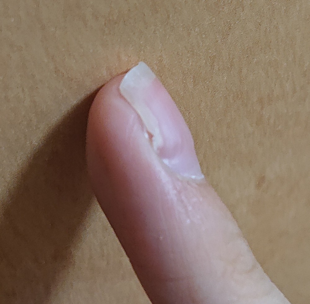 市販 爪 薬 白癬
