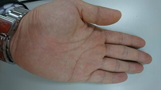 手相の鑑定お願いいたします 元カノと復縁したいですが 彼氏がいてうまく行きませ Yahoo 知恵袋