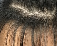 画像のような前髪の生え際のクセは治りませんか？
生え際以外は普通にストレートなんですけど､､

クセのせいで割れたりすることはあまりないのですがとても気になります。
縮毛矯正やストレ ートパーマなどで治るならやりたいです。
