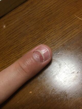 早い ピニオン 住む 爪 波打つ Otomi Nrc Jp