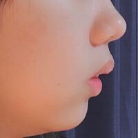 横顔がコンプレックスです 高校生です 小さい頃から指をしゃぶる Yahoo 知恵袋