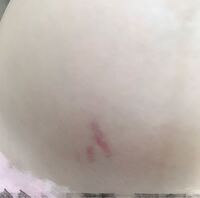 閲覧注意でお願いします 妊娠10ヶ月のものです 先程お風呂からあ Yahoo 知恵袋