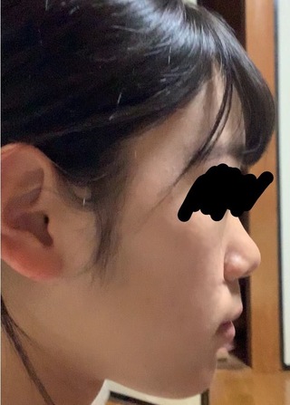 横顔について高二女子です 私は写真の通り横顔がとてつもなくブサイクで Yahoo 知恵袋