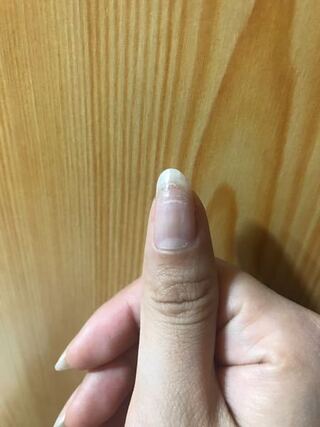 画像ありジェルネイルをサロンで落として貰ったのですがこの白い線は爪が Yahoo 知恵袋