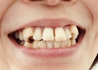 歯を見せずに上手に笑う方法自分の笑顔があまり好きではなく 写真のときにうま Yahoo 知恵袋