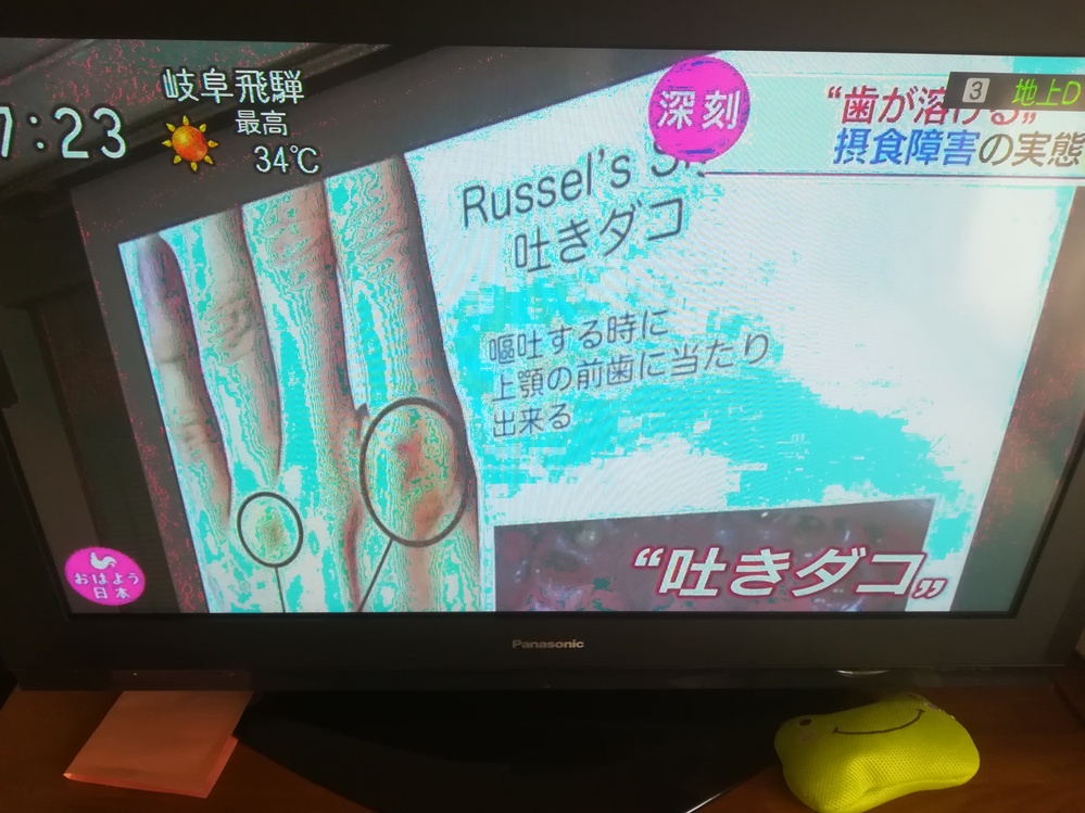 プラズマテレビですが、最近画面が写真のようにブルーがかかったように