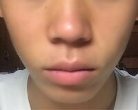 自分の顔の目から下が嫌いです 人中が長く 顎が短いです 整形せ Yahoo 知恵袋