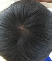 爪が汚いです 高校生女昔からそうなのですが ほぼ全部の指で縦筋が何 Yahoo 知恵袋