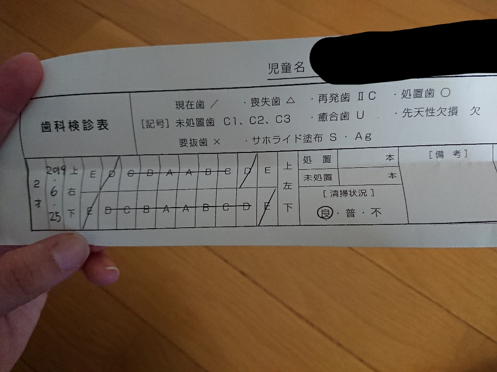 子供の歯科検診表の見方 2歳児です 斜線は現在歯とありますが どういう意 Yahoo 知恵袋