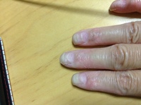 爪がデコボコしていて たまにぶつけると爪に割れ目が入ったりして 突っ Yahoo 知恵袋