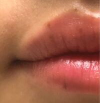 唇にいくつかほくろがあるのですが これが隠れるリップはありませんか ほく Yahoo 知恵袋