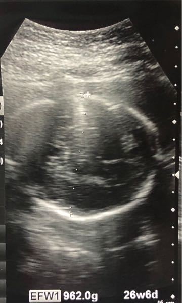 妊娠7ヶ月 男の子 に関するq A Yahoo 知恵袋