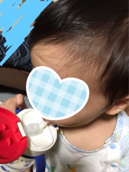 1歳3ヶ月の息子が3週間ほど前にベットの角でおでこをぶつけ 病院に連れて行き Yahoo 知恵袋