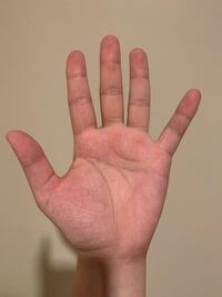 生理が10日以上こないのですが生理が遅れているのでしょうか そ Yahoo 知恵袋