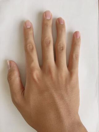 10代の男です よく手がキレイだと言われるのですがこれはキレイなので Yahoo 知恵袋