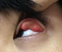 上瞼がゴロゴロしてたので裏返してみたところこんなふうになっていました Yahoo 知恵袋