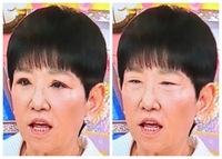 和田アキ子の今の顔は左ですが 元は右みたいな顔 整形失敗してる あの顔で Yahoo 知恵袋