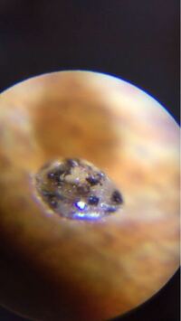 メダカの水槽にいた泳ぐ黒い点々について 顕微鏡で見てみたのです Yahoo 知恵袋