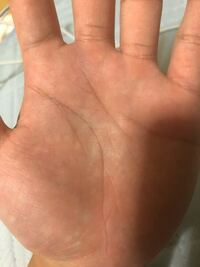 手相を鑑定してほしいです 高2女 生命線と頭脳線が異常に離れてる Yahoo 知恵袋