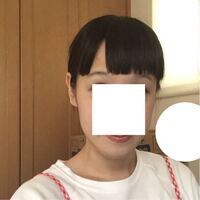 症候群 マル ファン