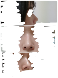 光が当たると鼻低く見えてて 影があると高く見えます 真正面 そん Yahoo 知恵袋