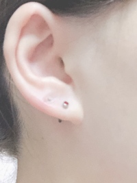 今日 ぷりぴあというメーカーのピアッサーで耳たぶにピアスを開けました 薬局にこ Yahoo 知恵袋