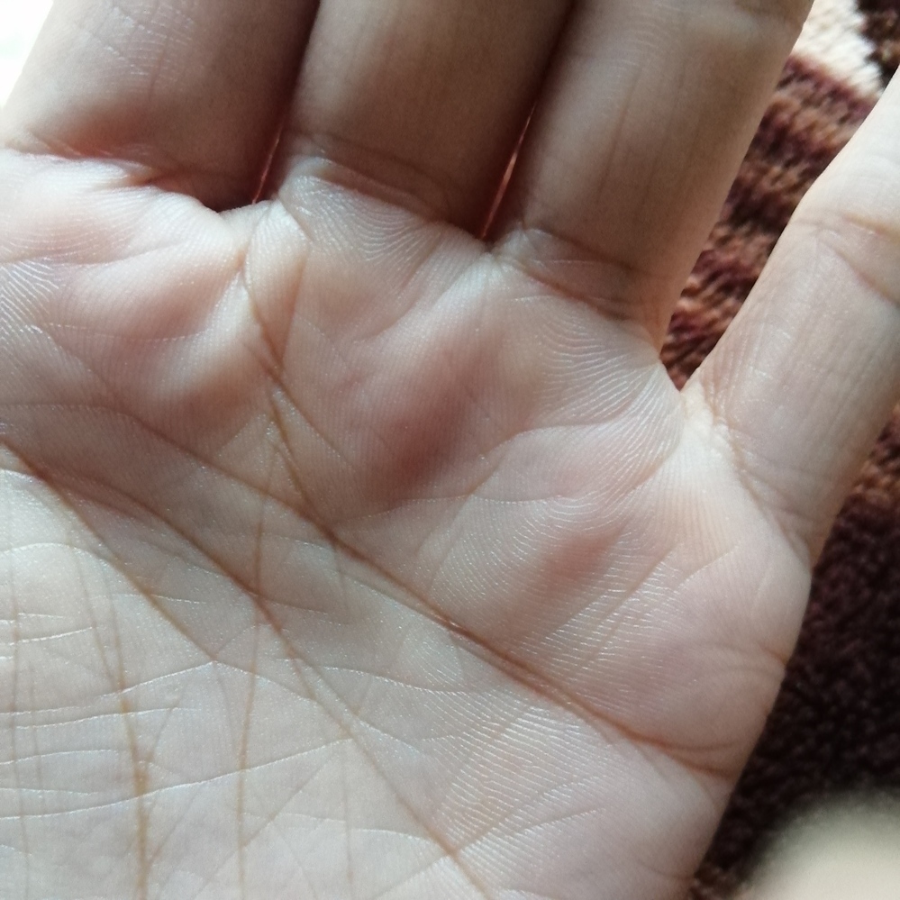 太陽環かどうか 見て頂きたいです 手相に詳しい方 どうぞよろしくお願い致します Yahoo 知恵袋