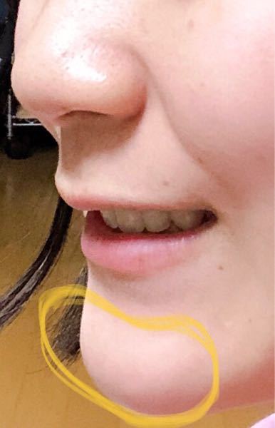 オトガイ筋 に関するq A Yahoo 知恵袋