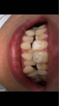 何が原因かわからないのですが子供の頃から歯が黄色いのですが 歯医者に Yahoo 知恵袋
