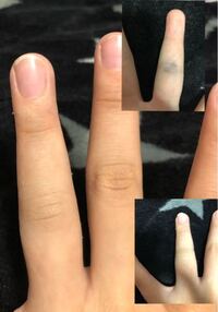 突き指をする方法 今 私は学校でバスケットボールをやって Yahoo 知恵袋
