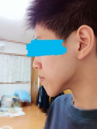 これってしゃくれてますか 学校でさんざんいじられ 結構頭に来て Yahoo 知恵袋