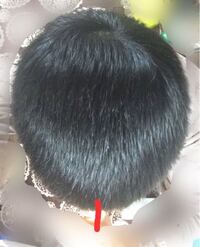 頭の形いびつでしょうか 画像の赤線が眉間にあたります Yahoo 知恵袋