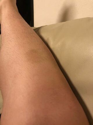 野球部に所属してる高校2年生です 最近メニューのランの後に痛み Yahoo 知恵袋