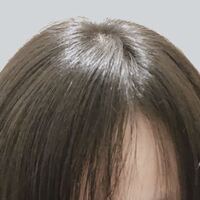 ４０歳女性です 率直にこの分け目は薄いですか 一般的に 女性の Yahoo 知恵袋