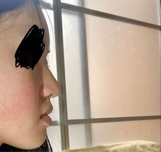 顔が真っ平らです のっぺりです 鼻はそこまで低いわけではないと思いますが Yahoo 知恵袋