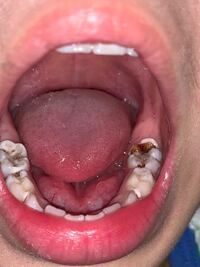 もぉすぐ4歳になる息子 歯は大事にしてほしいと思い念入りにしっかり歯磨きしてい Yahoo 知恵袋