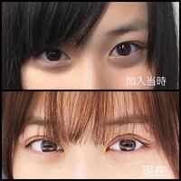 乃木坂の山下美月さんについてです。 加入当時と現在の目が相当違いますよね、。
こんなに変わるものなんですか？

昔も今も可愛いのは変わりないですけどね、。