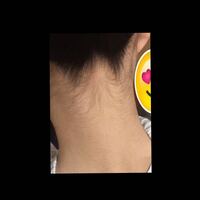 うなじの毛が汚いので処理したいのですが脱毛サロンに通うしかないでしょうか Yahoo 知恵袋